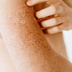 Cách điều chỉnh khi Da bị kích ứng mà không cần dùng Cortisone