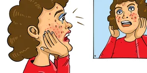 MỤN:  Ám Ảnh Của Làn Da