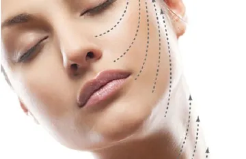 Nâng cơ trẻ hóa da công nghệ IONTOSON Nâng cơ trẻ hóa da công nghệ IONTOSON