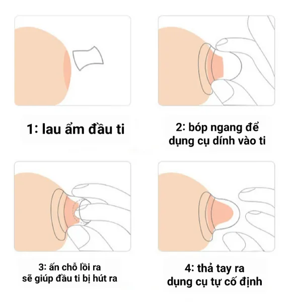 Hút núm SM