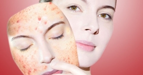 serum-tri-mun-skinaz