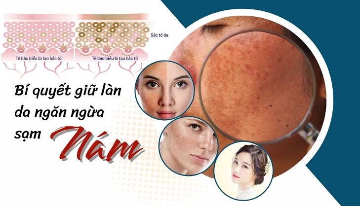 Bí quyết giữ làn da ngăn ngừa sạm nám