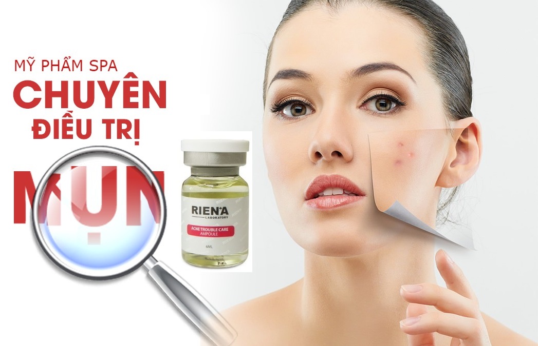 dieu tri mun tan goc rien'a