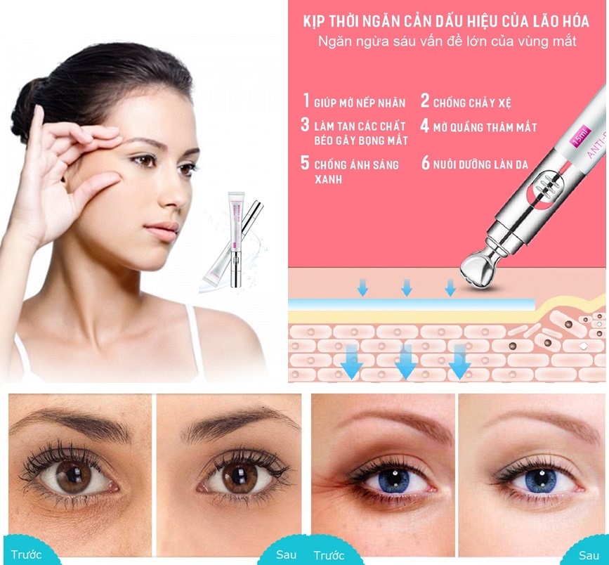 kem tri tham quang mat 2