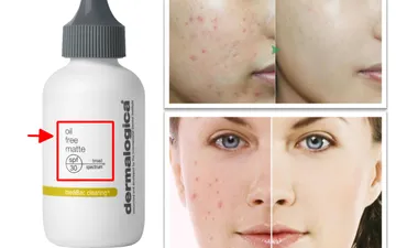 Oil Free là gì ? Tại sao Dành Cho Da Nhờn Mụn ? Có ý nghĩa ?