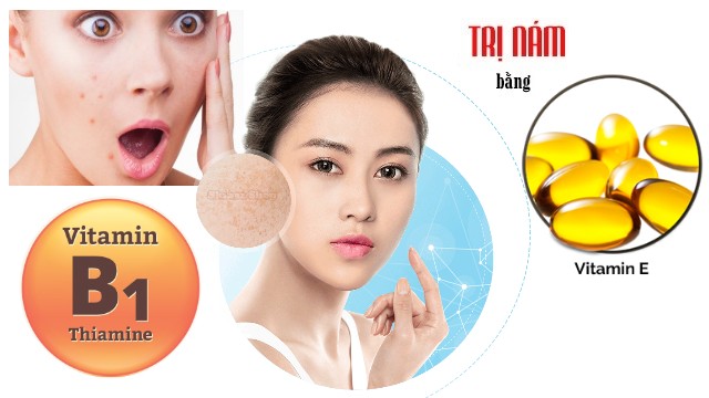 Trị nám bằng vitamin B1 và vitamin E: Phương pháp tự nhiên an toàn cho làn da sáng mịn