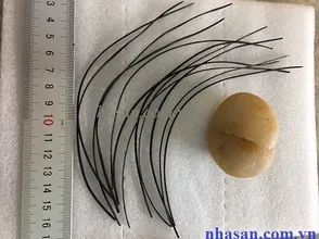 EFFECTS AND MEANINGS OF THE TAIL FARM