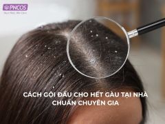 Cách gội đầu cho hết gàu tại nhà chuẩn chuyên gia
