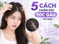 Bật mí 5 cách chăm sóc tóc gàu tại nhà đơn giản, dễ thực hiện
