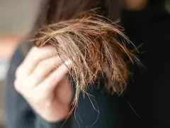 KHẮC PHỤC TÌNH TRẠNG TÓC XƠ VÀ CHẺ NGỌN