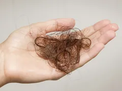 RỤNG TÓC BAO NHIÊU LÀ BÌNH THƯỜNG ?
