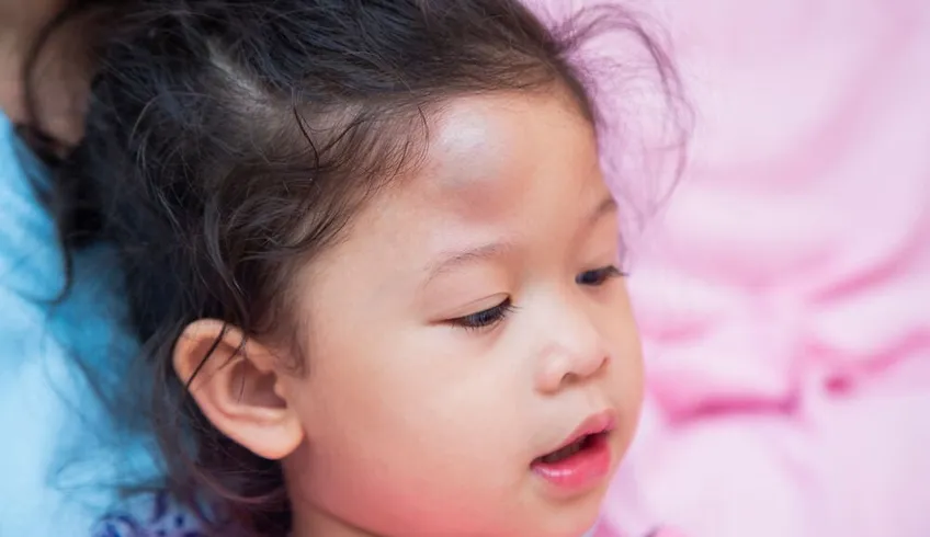 Bé bị ngã đập đầu phía sau có sao không? Cha mẹ cần làm gì?