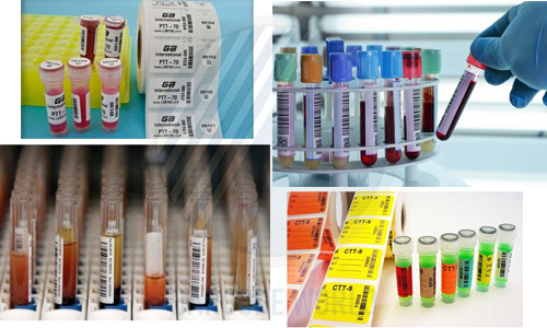 Tem ống nghiệm mẫu xét nghiệm Tem ống nghiệm mẫu xét nghiệm