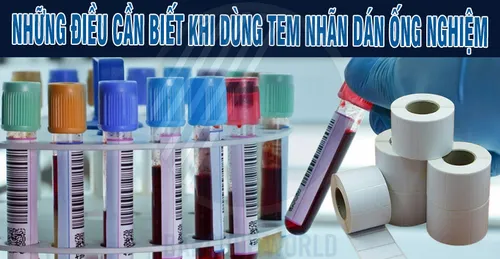 NHỮNG ĐIỀU CẦN BIẾT KHI DÙNG TEM NHÃN DÁN ỐNG NGHIỆM