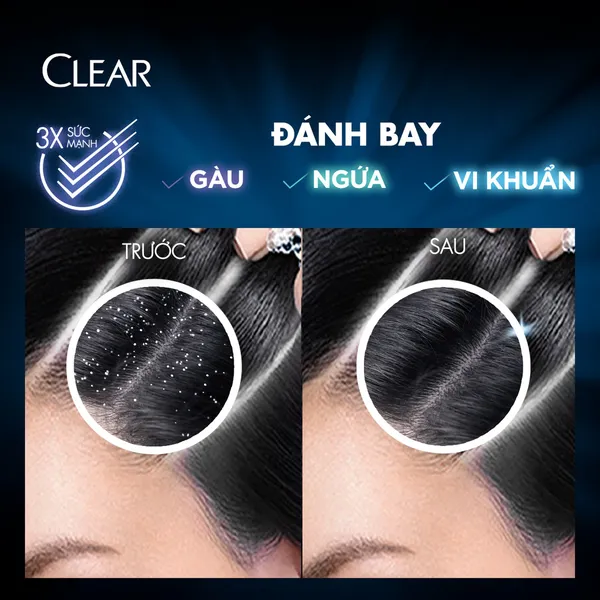 Dầu gội đầu clear sạch gàu ngứa và vi khuẩn suốt 24 Giờ 630g