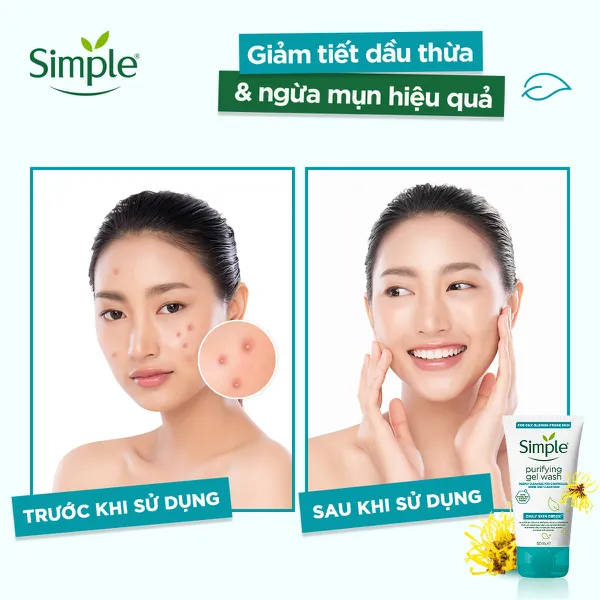 Sữa rửa mặt Simple Cấp ẩm cho da khô nhạy cảm 150ml