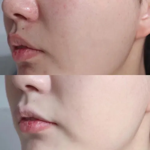 Phấn Phủ Gucci Poudre De Beauté Mat Naturel