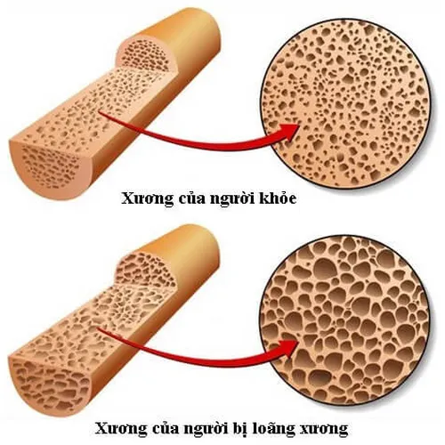 Viên uống Canxi Kirkland Calcium 600mg + D3 hộp 500 viên của Mỹ