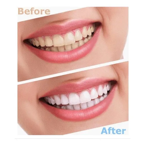 Kem Đánh Răng Crest Pro-Health Densify 116G - Tăng Cường Phục Hồi Men Răng - Mỹ