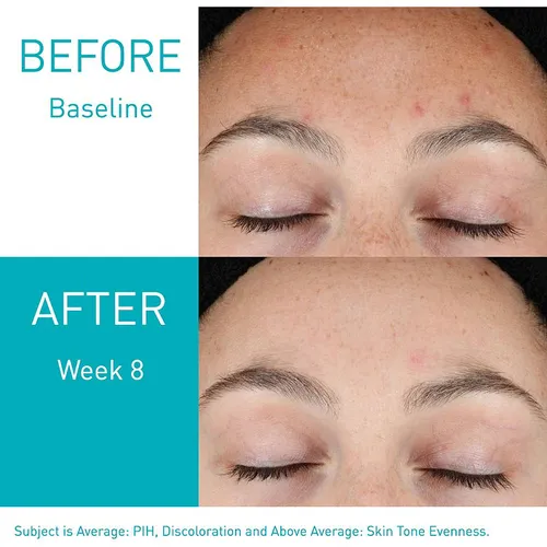 Tinh Chất Chống Lão Hoá, Tái Tạo Da Cerave Resurfacing Retinol Serum 30ML