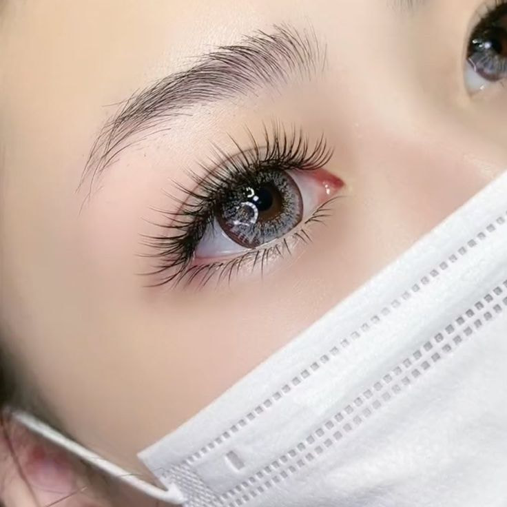 Bị cận có nên nối mi