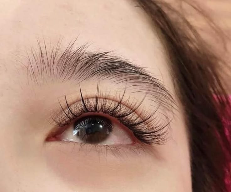 Mi nối giữ được bao lâu
