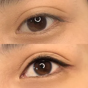 Sụp Mí Có Nên Xăm Mí Mắt? Hướng Dẫn Lựa Chọn An Toàn