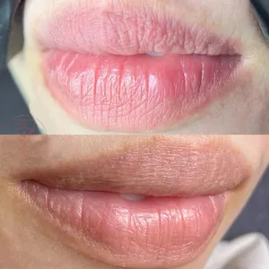 Khử Thâm Môi Kiêng Ăn Gì? Hướng Dẫn Chăm Sóc Đúng Cách