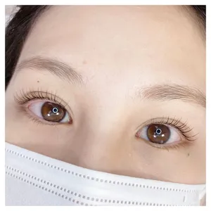 Mi Mắt Bị Ngứa: Nguyên Nhân Phổ Biến Và Cách Khắc Phục Hiệu Quả