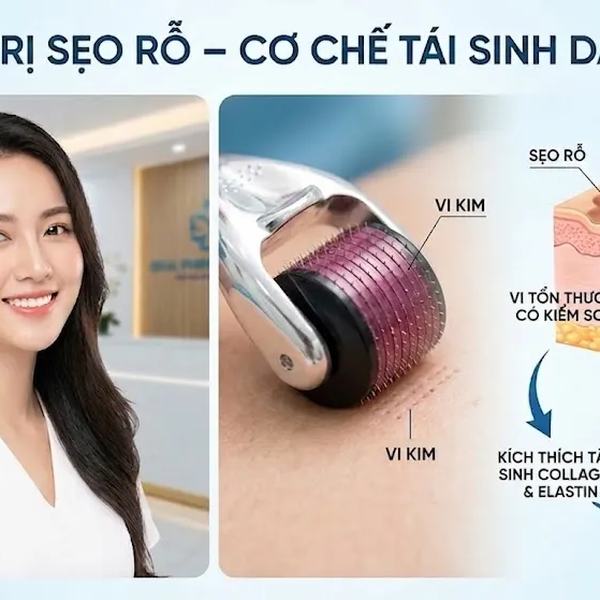 Grace Spa – Địa Chỉ Trị Sẹo Rỗ Uy Tín Tại Bình Dương: Công Nghệ Lăn Kim Vi Điểm Chuẩn Hoa Kỳ
