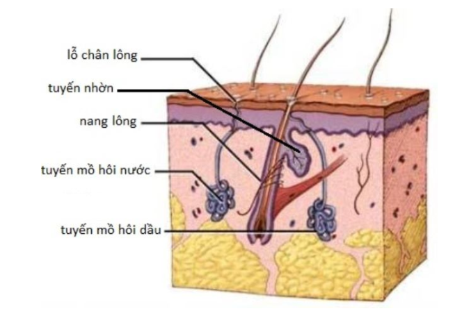 Bé bị rôm sẩy mụn nhọt do tuyến mồ hôi bị tắc nghẽn, không thoát ra được do da tiết chất nhờn làm bít các tuyến mồ hôi Bé bị rôm sẩy mụn nhọt do tuyến mồ hôi bị tắc nghẽn, không thoát ra được do da tiết chất nhờn làm bít các tuyến mồ hôi