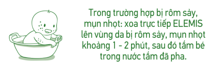 Nhớ lưu ý cách tắm cho trẻ khi bị rơm sẩy mẹ nhé! Nhớ lưu ý cách tắm cho trẻ khi bị rơm sẩy mẹ nhé!