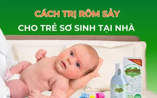 Cách trị rôm sảy cho trẻ sơ sinh tại nhà hiệu quả nhất