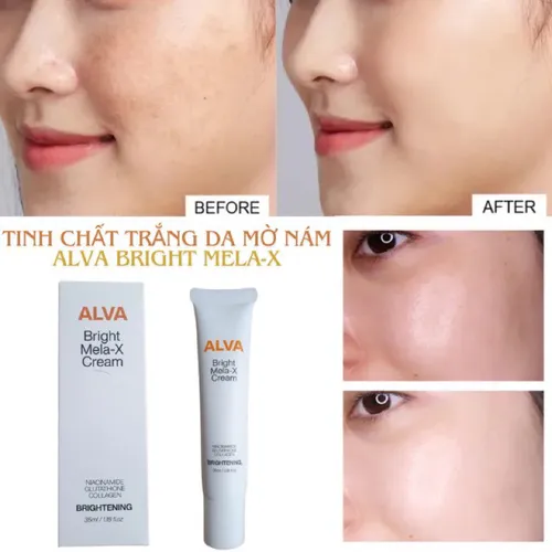 Kem Trắng da Alva Bright Mela-X Cream Hàn Quốc
