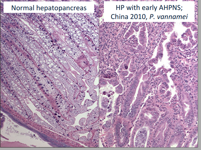 Mô bệnh học gan tụy tôm khỏe (A) và mô bệnh học gan tụy tôm nhiễm AHPND (B)