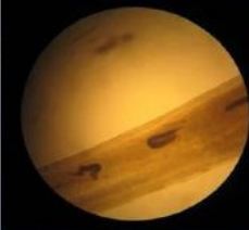 Gregarin trong ruột của tôm bệnh phân trắng