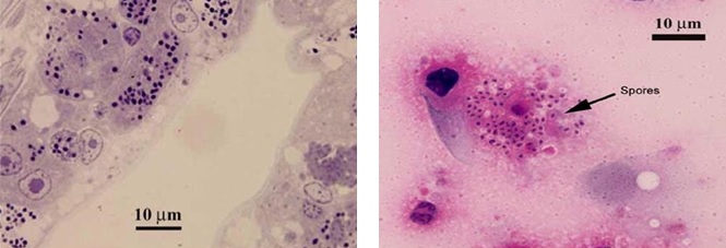 Ảnh nhuộm tế bào biểu mô của EHP Ảnh nhuộm tế bào biểu mô của EHP