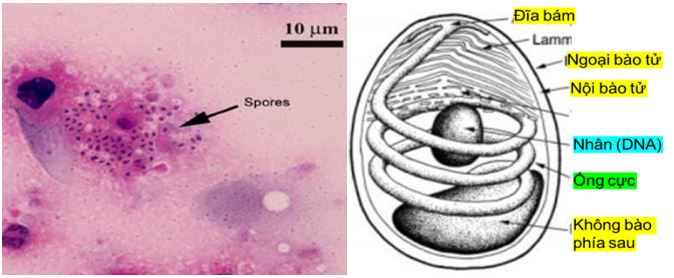 Ảnh nhuộm tế bào biểu mô của EHP (bên trái) và cấu tạo EHP (bên phải) Ảnh nhuộm tế bào biểu mô của EHP (bên trái) và cấu tạo EHP (bên phải)