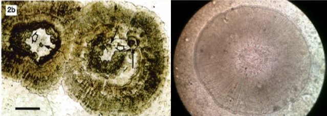 Đốm trắng do khuẩn (bên trái) và đốm trắng do virus (bên phải)