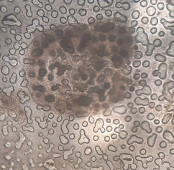 Đốm trắng do virus trên tôm Đốm trắng do virus trên tôm