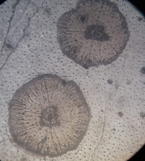 Đốm trắng do virus trên tôm Đốm trắng do virus trên tôm