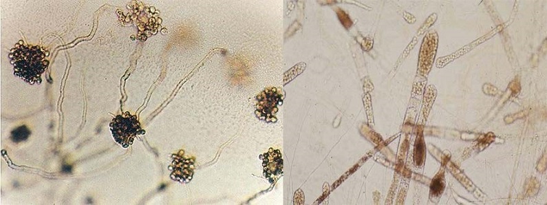 bệnh lở loét trên cá lóc