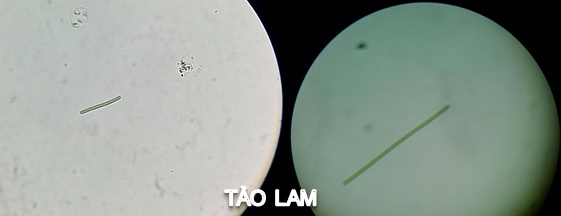 tảo lam trong ao nuôi tôm