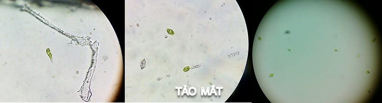 tảo mắt trong ao nuôi tôm