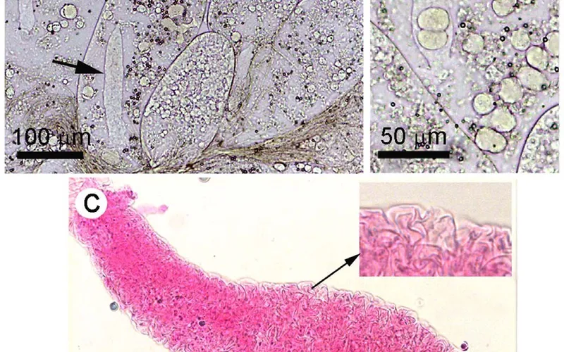 Một số ký sinh trùng gây bệnh đường ruột trên tôm và cách phòng ngừa