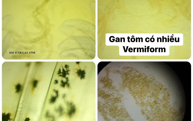 Cách khắc phục ký sinh trùng Vermiform trong ruột và gan tôm - Chẩn đoán từ phòng xét nghiệm của Mỹ Bình