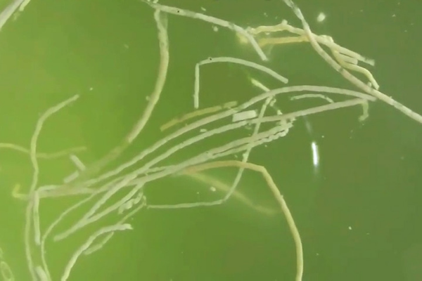 tôm bị phân trắng