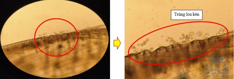 Trùng loa kèn bám trên phụ bộ tôm Trùng loa kèn bám trên phụ bộ tôm