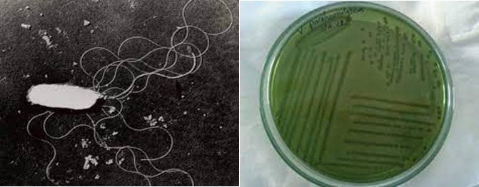 Vi khuẩn Vibrio parahaemolyticus gây vàng gan và teo gan trống ruột trên tôm Vi khuẩn Vibrio parahaemolyticus gây vàng gan và teo gan trống ruột trên tôm