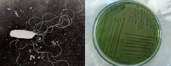 Vi khuẩn Vibrio parahaemolyticus Vi khuẩn Vibrio parahaemolyticus